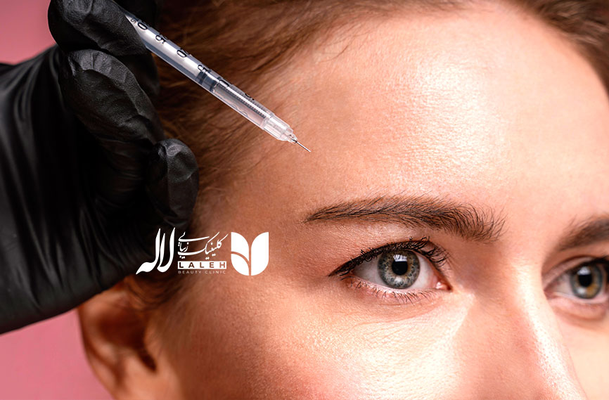 مزوتراپی ابروی طبیعی