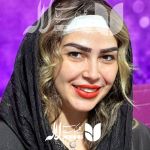 کاشت ابرو