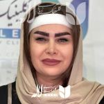 کاشت ابرو